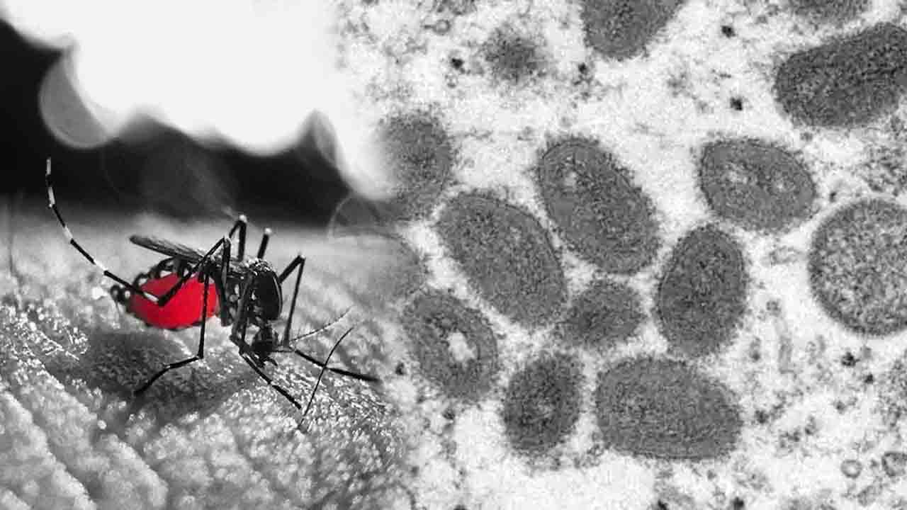 Black Fever | బెంగాల్‌లో బ్లాక్‌ ఫీవర్‌ కలకలం..!