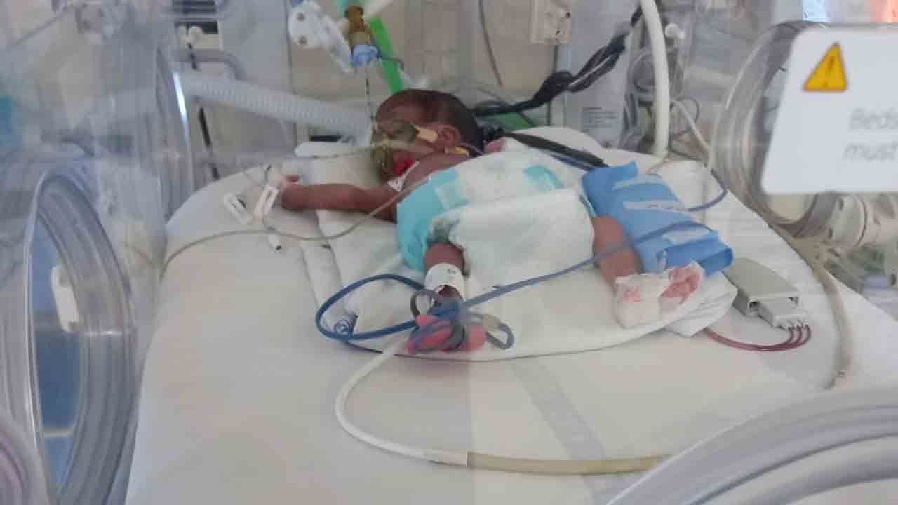 వెంటిలేటర్‌పై పసిప్రాణం!