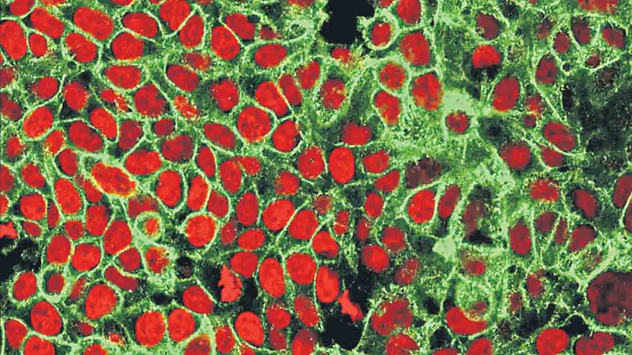 ఆరోగ్యకర కణాలు నష్టపోకుండా క్యాన్సర్‌ చికిత్స