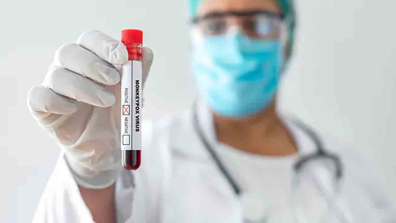 స్పెయిన్‌లో తొలి మంకీపాక్స్‌ మరణం..