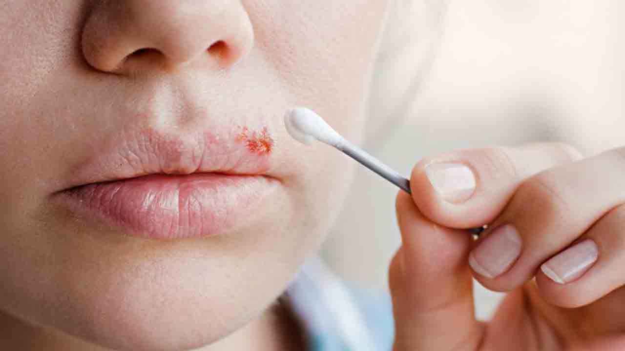 కాంస్య యుగంలో ముద్దులు.. ఇప్పుడు దద్దుర్లు!