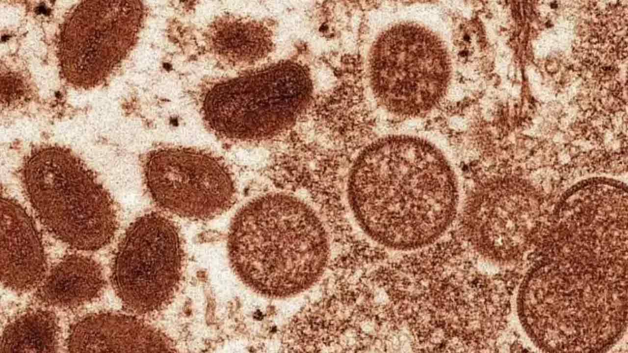 Monkeypox scare: మంకీపాక్స్ వైర‌స్‌ను గుర్తించేందుకు దేశ‌వ్యాప్తంగా 15 లాబొరేట‌రీల‌కు శిక్ష‌ణ‌: ఐసీఎంఆర్‌