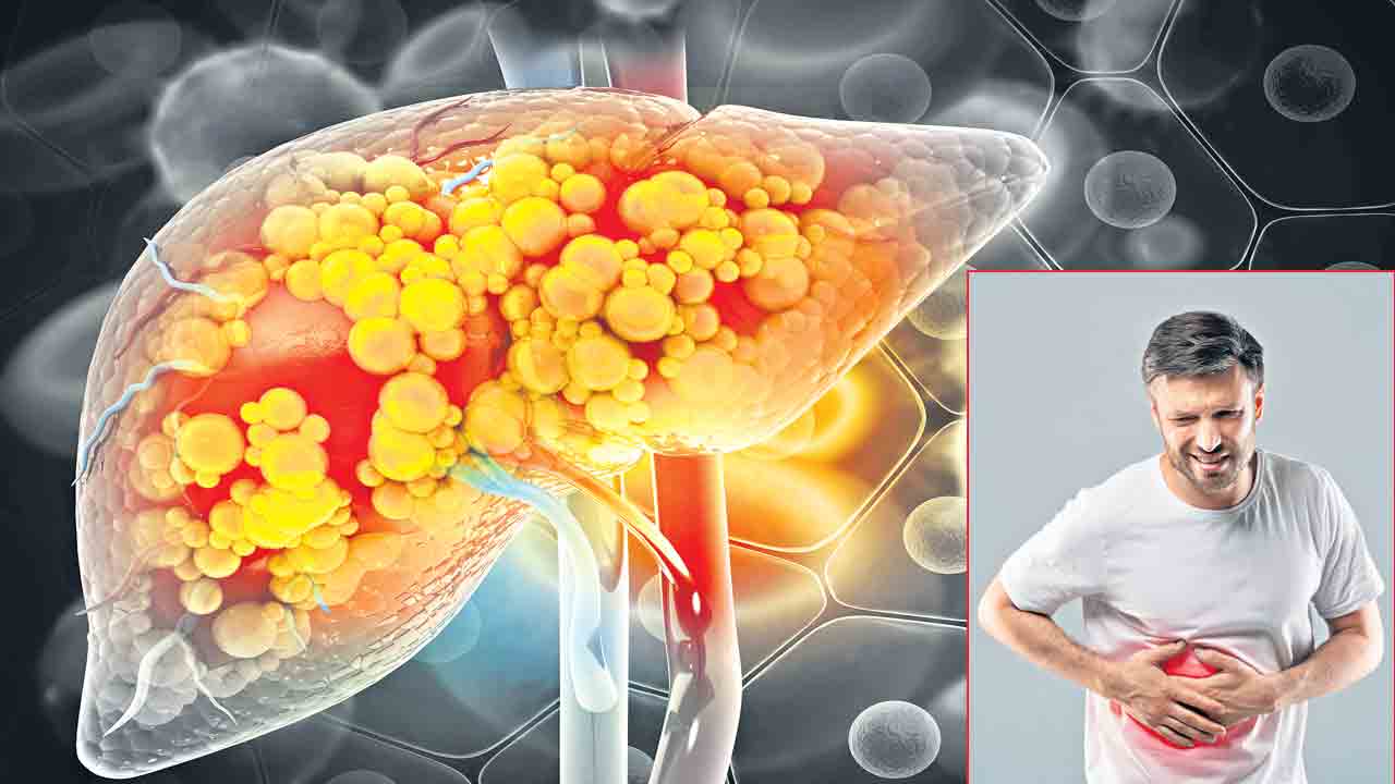 కాలేయాన్ని.. కాపాడుకుందాం!