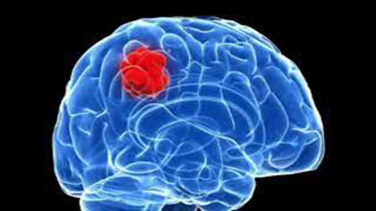 మెదడు కణాలతో క్యాన్సర్‌ కణాల దోస్తీ!