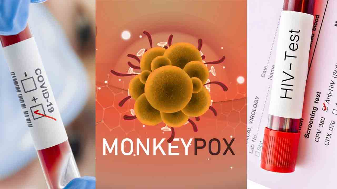 ఒకేసారి కరోనా, మంకీపాక్స్‌, హెచ్‌ఐవీ పాజిటివ్‌.. ప్రపంచంలో తొలి కేసు ఇదే..!