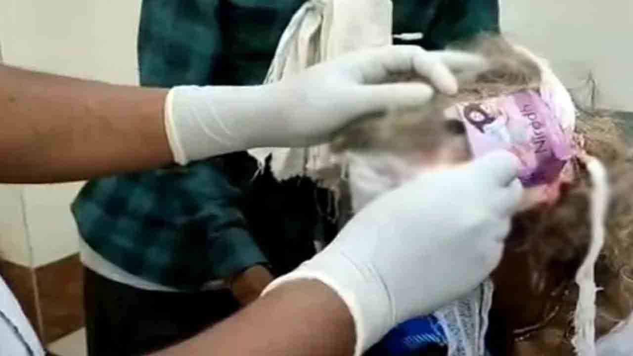 మధ్యప్రదేశ్‌లో దారుణం… మహిళ తల గాయానికి కండోమ్‌ ప్యాక్‌తో కట్టు