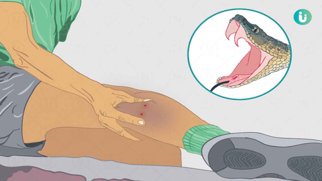 పాము కరిచిందా.. భయం వద్దు