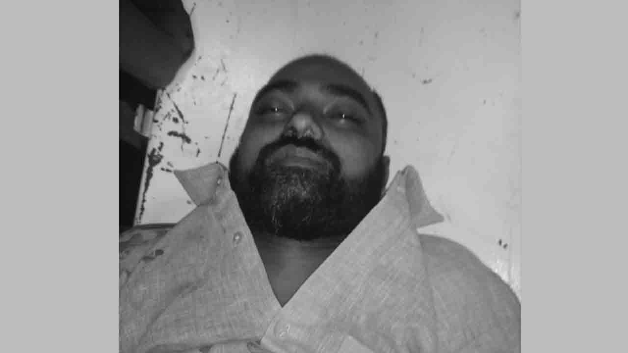 మాదాపూర్‌లో కాల్పుల కలకలం.. ఒకరు మృతి