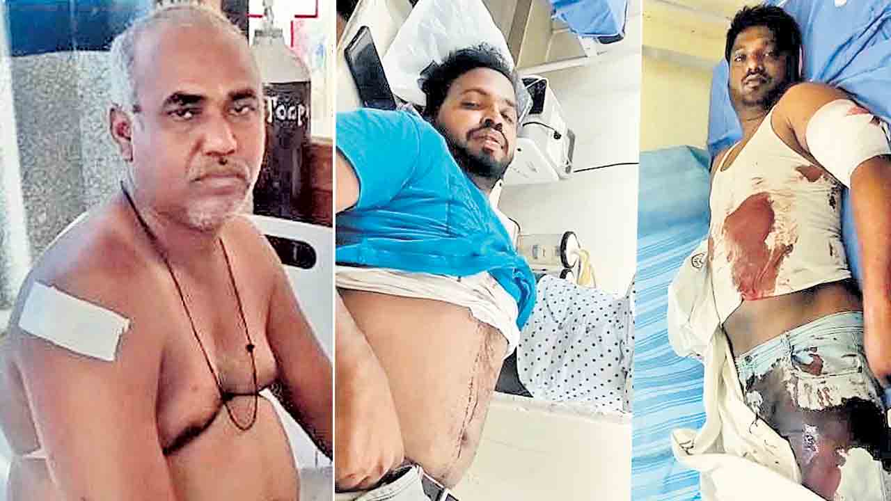 తూప్రాన్‌లో దోపిడీ దొంగల బీభత్సం