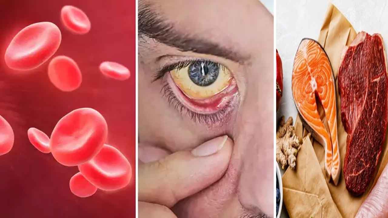 Anemia | రక్తహీనత సమస్యా..? ఇలా తెలుసుకొండి..!