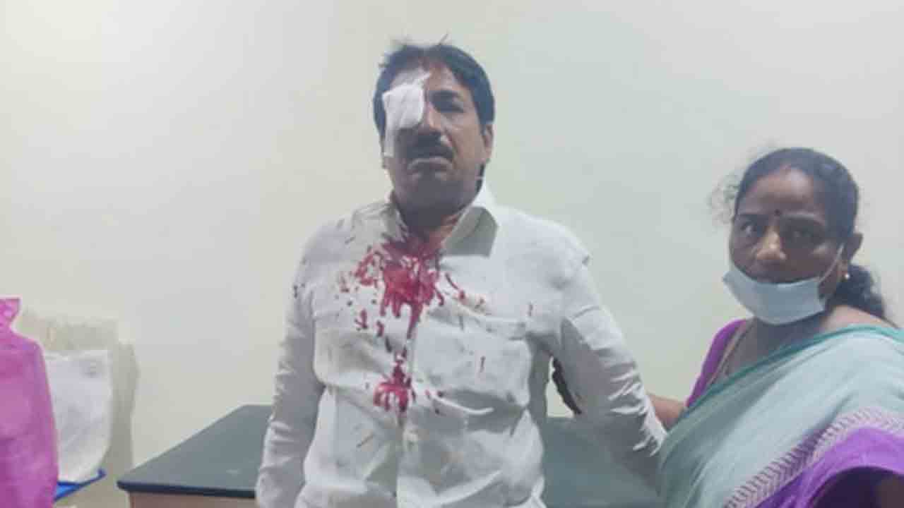 విజ‌య‌వాడ‌లో వైఎస్ఆర్ కాంగ్రెస్ దాడి.. టీడీపీ నేత‌కు గాయాలు