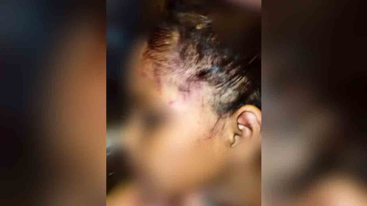 హోంవర్క్‌ చేయలేదని చిన్నారులను విచక్షణారహితంగా కొట్టిన ట్యూషన్‌ టీచర్‌