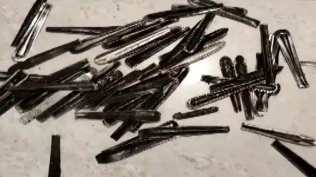 ఏడాదిగా స్టీల్‌ స్పూన్లు తింటున్న వ్యక్తి… ఆపరేషన్‌ చేసి 62 స్పూన్లు తొలగించిన డాక్టర్లు