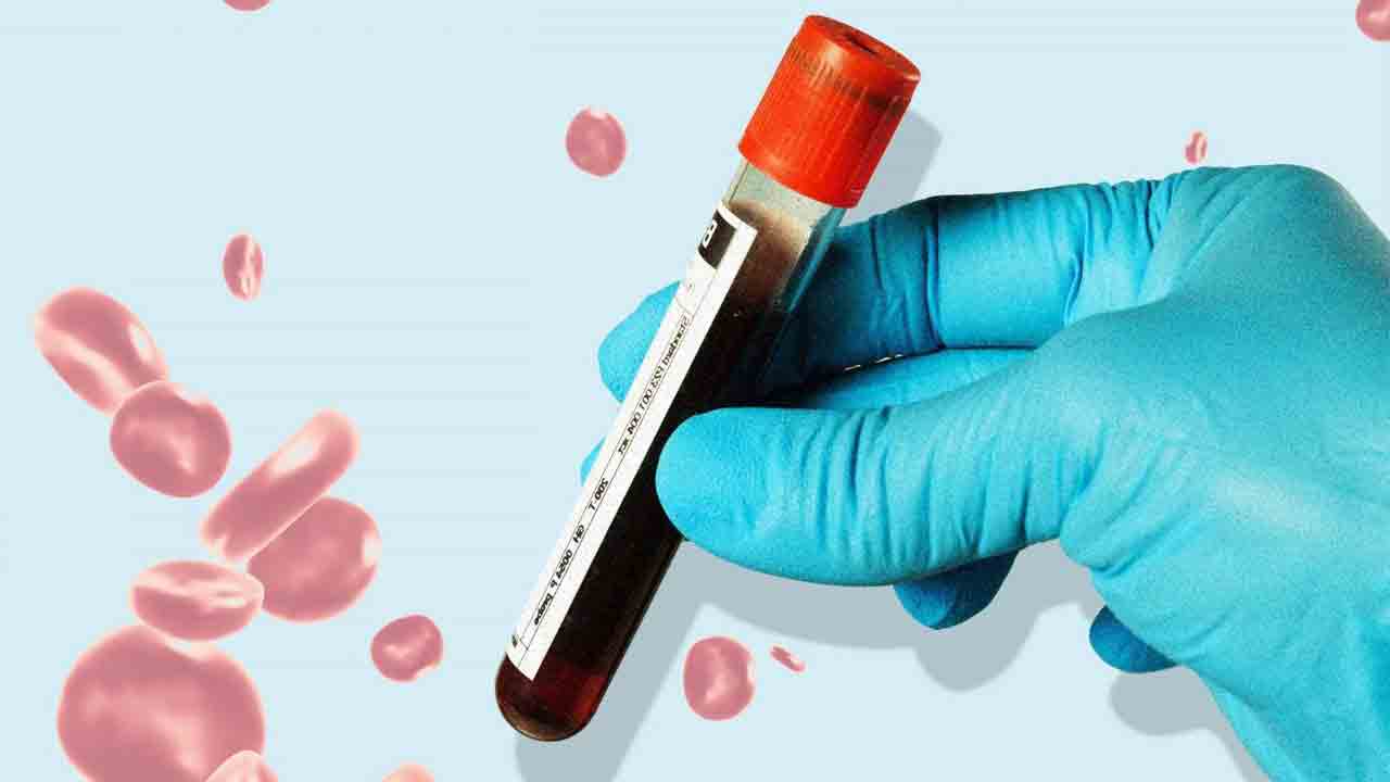 దీర్ఘకాలంలో కొవిడ్‌ ముప్పును గుర్తించేందుకు రక్త పరీక్ష