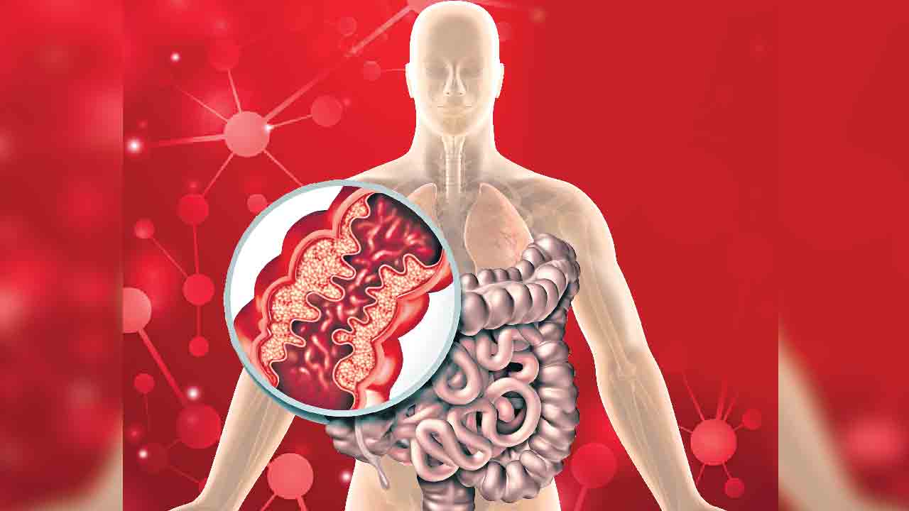 పేగు పూత గుండెకోత!