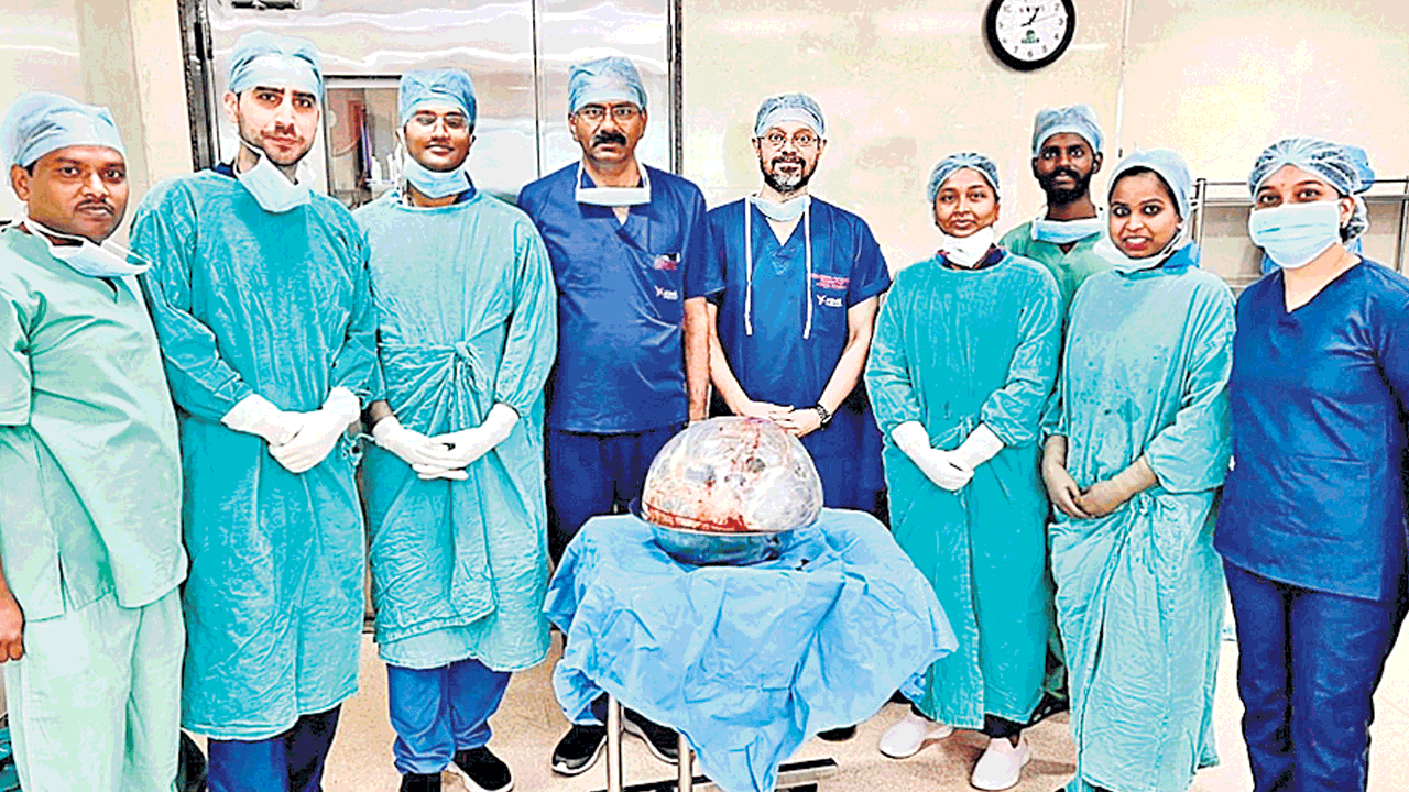 మహిళ గర్భాశయంలో నుంచి 23.7 కిలోల కణితి తొలగింపు
