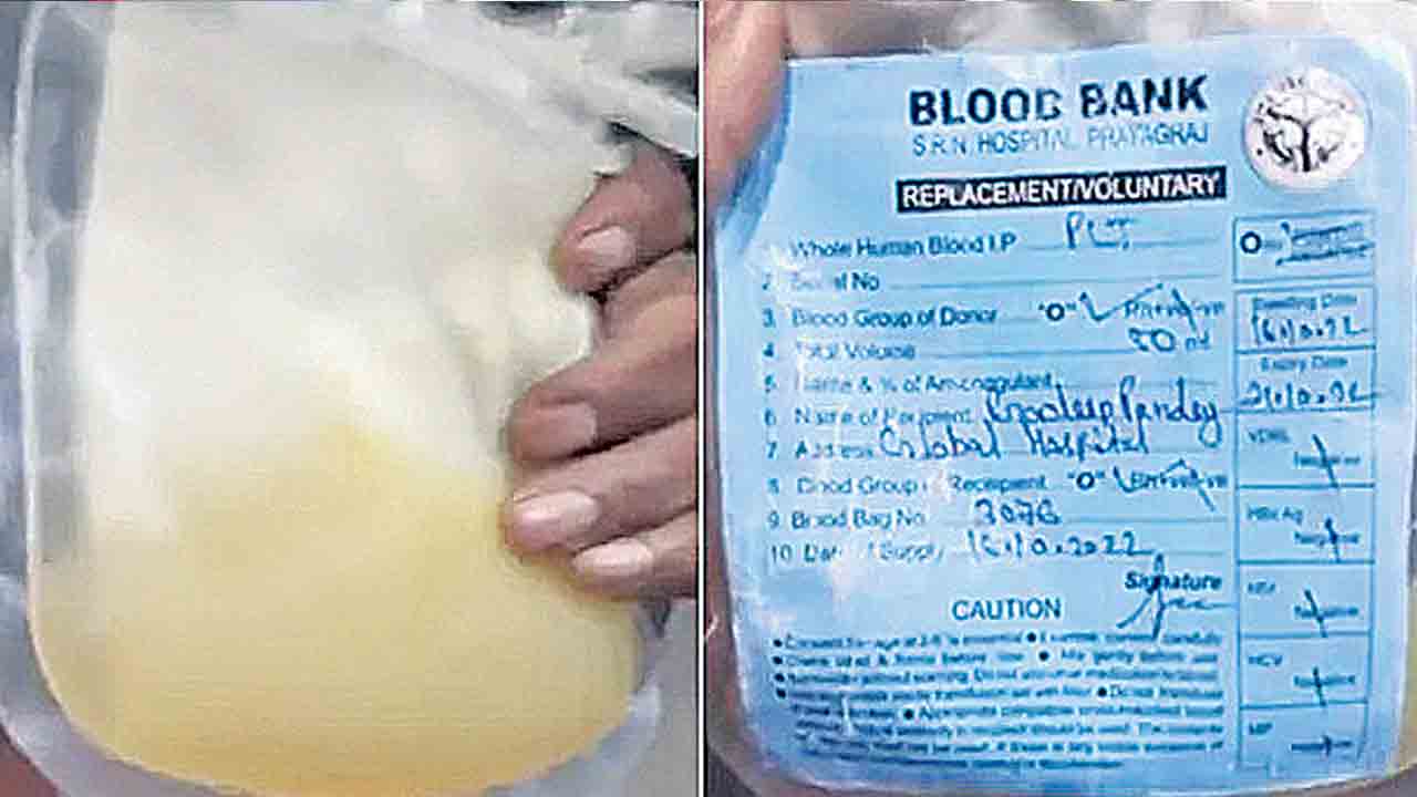 రోగికి ప్లాస్మా బదులు బత్తాయి రసం
