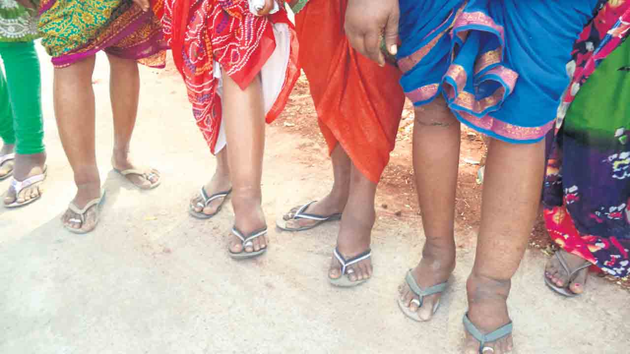 బాధకాలు