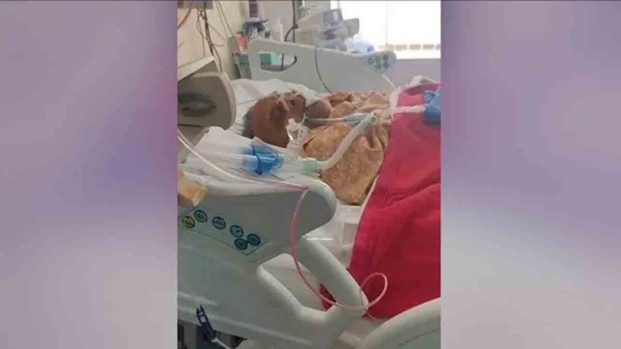 విషమంగానే ములాయం సింగ్‌ యాదవ్‌ ఆరోగ్యం