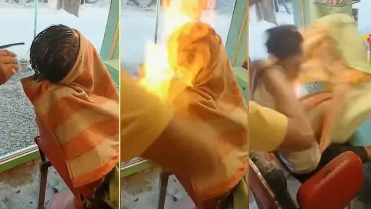 Fire Haircut | ‘ఫైర్‌ హెయిర్‌కట్‌’ చేస్తుండగా… యువకుడికి గాయాలు