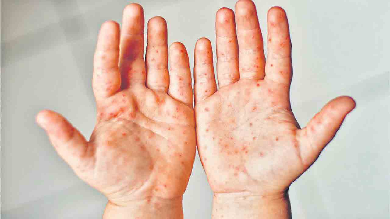 వానాకాలం శత్రువు