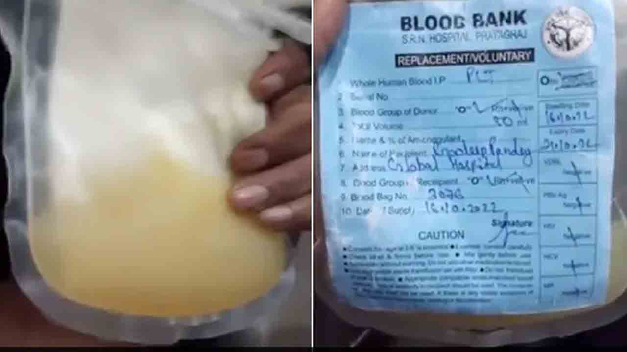 యూపీలో దారుణం.. డెంగీ రోగికి మోసంబి జ్యూస్ ఎక్కించడంతో మృతి