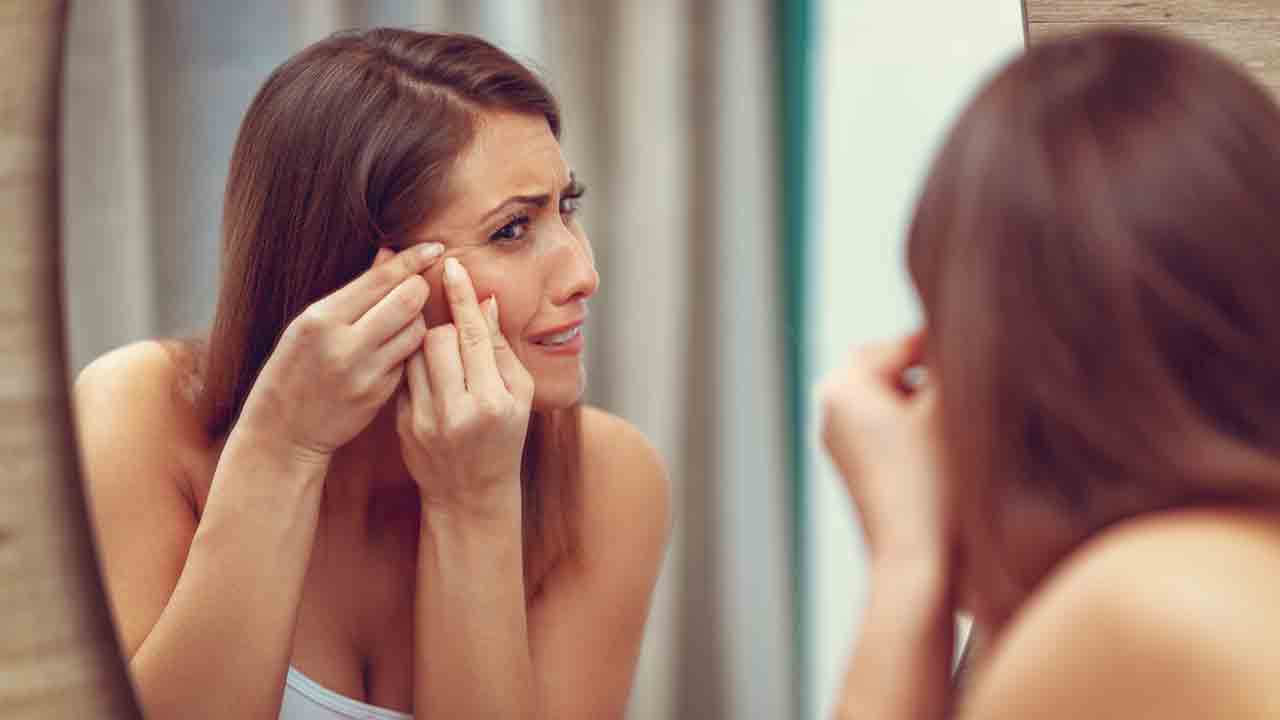 Beauty tips | పదే పదే వచ్చే మొటిమలతో ఇబ్బంది పడుతున్నారా? మీ సమస్యకు ఇలా శాశ్వతంగా చెక్‌ పెట్టేయండి!