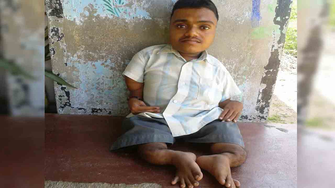 బీజేపీకి ఫ్లోరోసిస్‌ బాధితుల శాపనార్థాలు