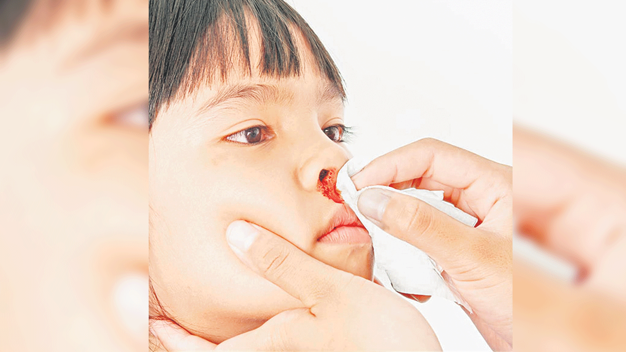 ముక్కు నుంచి రక్తం దేనికి సంకేతం?