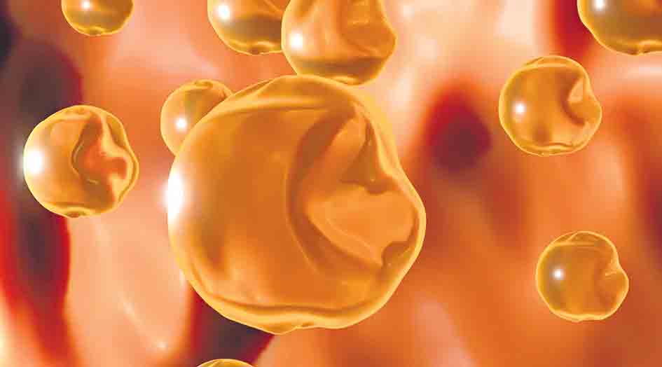 కొలెస్ట్రాల్‌కు కొత్త మందు