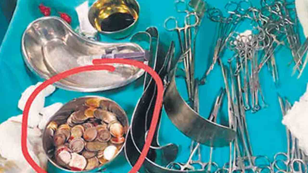 కడుపులో 187 కాయిన్స్‌!