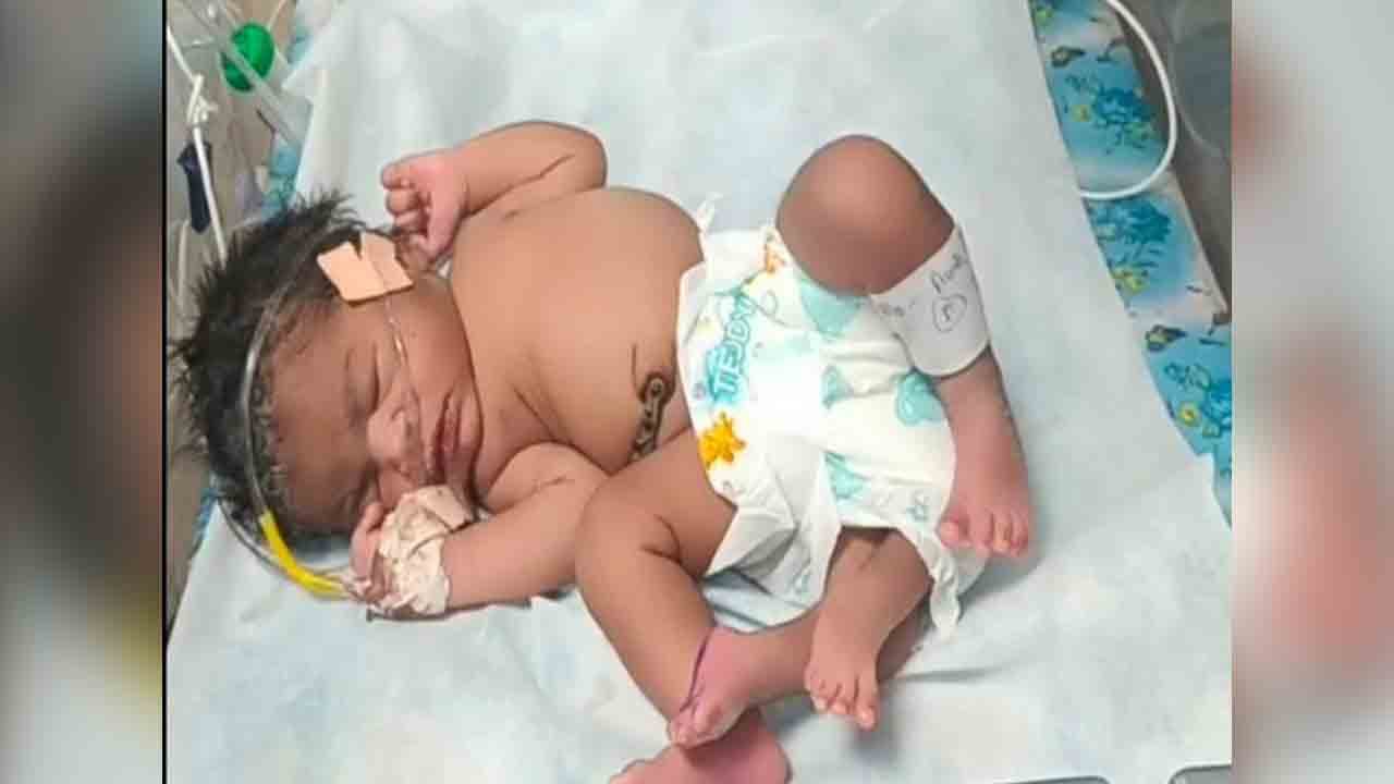 Viral News | నాలుగు కాళ్లతో జన్మించిన చిన్నారి.. మధ్యప్రదేశ్‌లో ఘటన