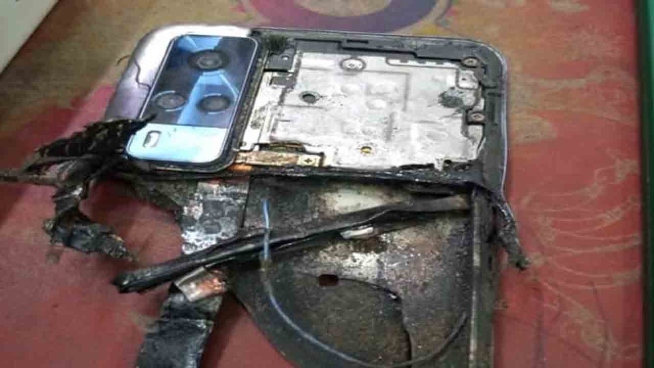 గేమ్స్‌ ఆడుతుండగా పేలిన మొబైల్‌.. బాలుడికి తీవ్ర గాయాలు..!