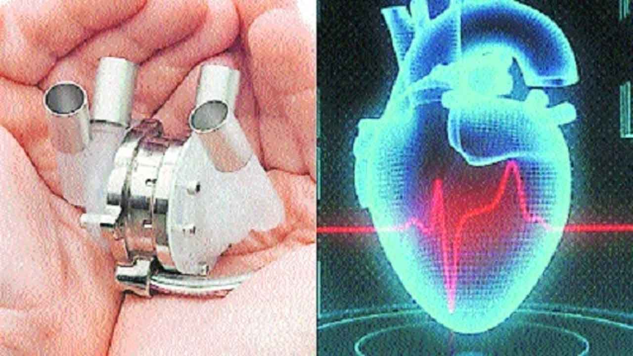 Artificial Heart | కృత్రిమ గుండెను తయారు చేసిన ఐఐటీ కాన్పూర్‌ వైద్యులు