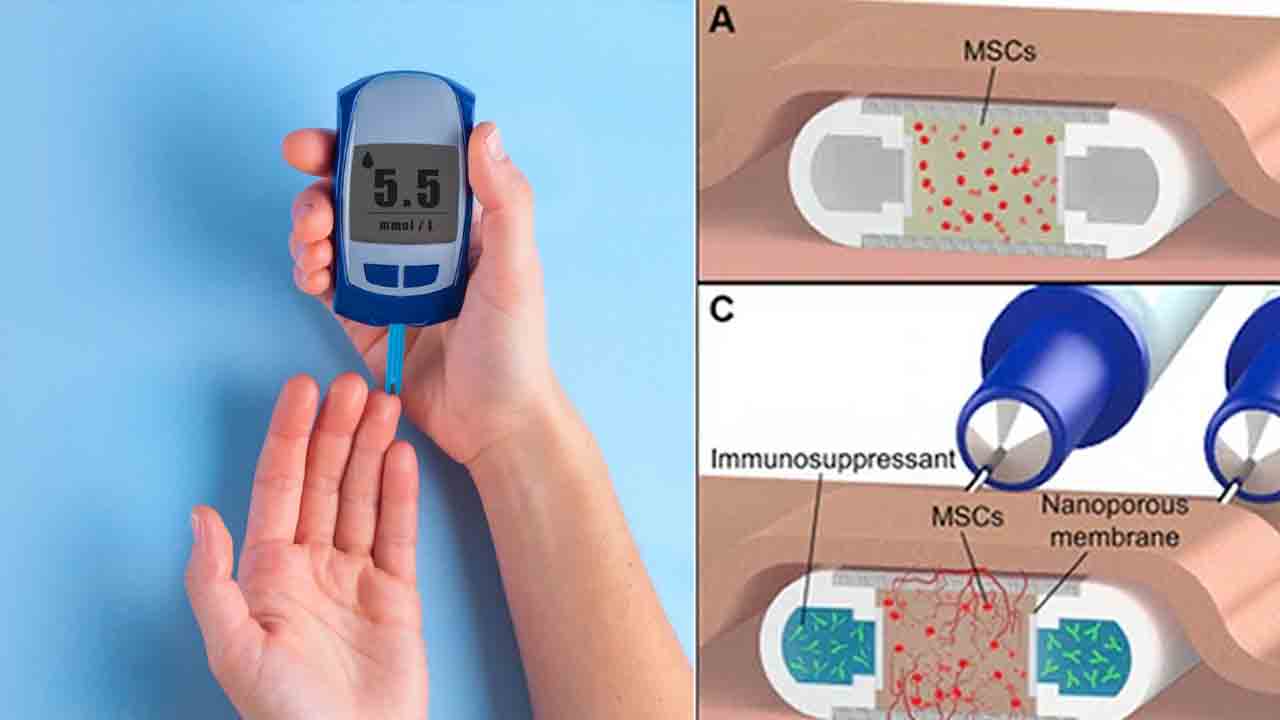 మధుమేహ చికిత్సకు అధునాతన పరికరం