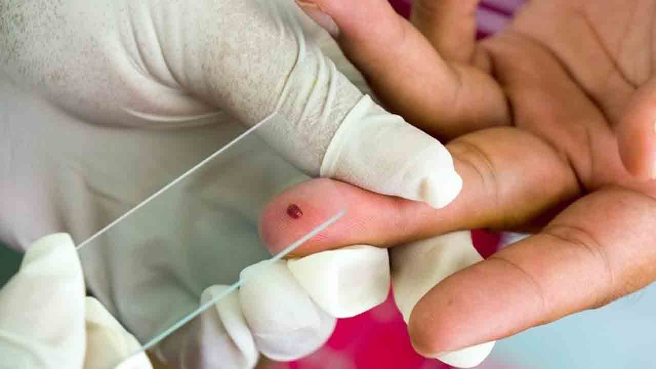 సూది గుచ్చకుండా మలేరియా టెస్ట్‌!