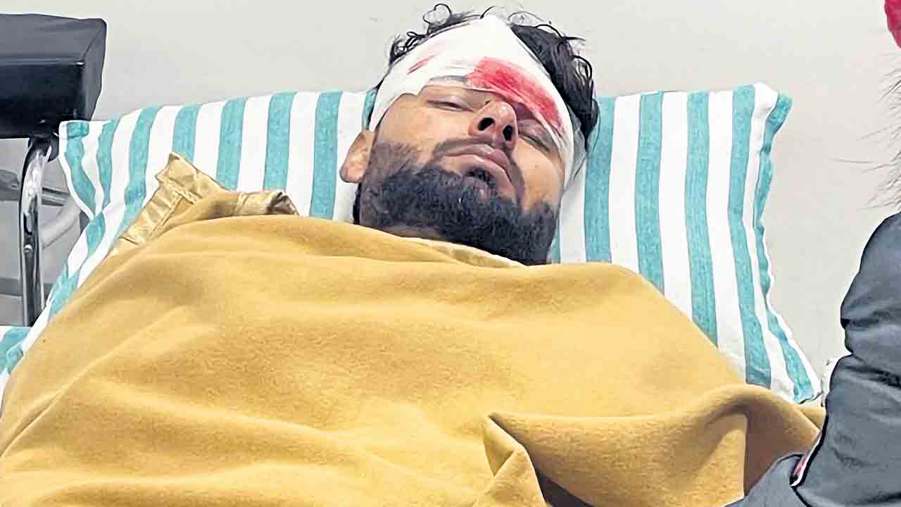 పంత్‌కు ప్రమాదం  