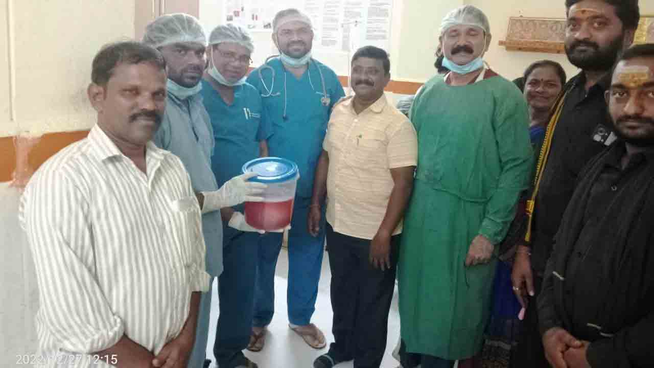 గ‌ర్భ సంచిలో భారీ క‌ణ‌తి.. తొల‌గించిన క‌మ్యూనిటీ హెల్త్ సెంట‌ర్ వైద్యులు..