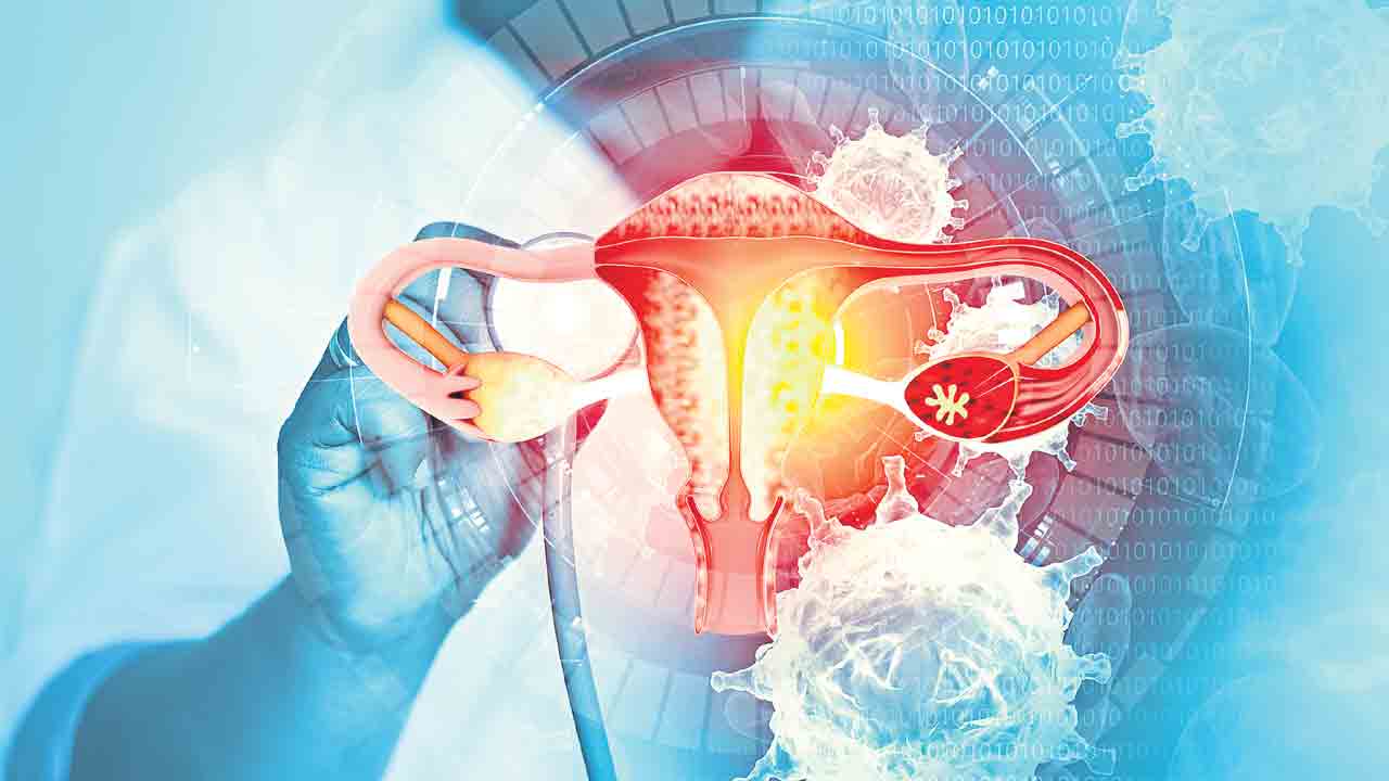 సర్వికల్‌కు.. సరైన పరిష్కారం!