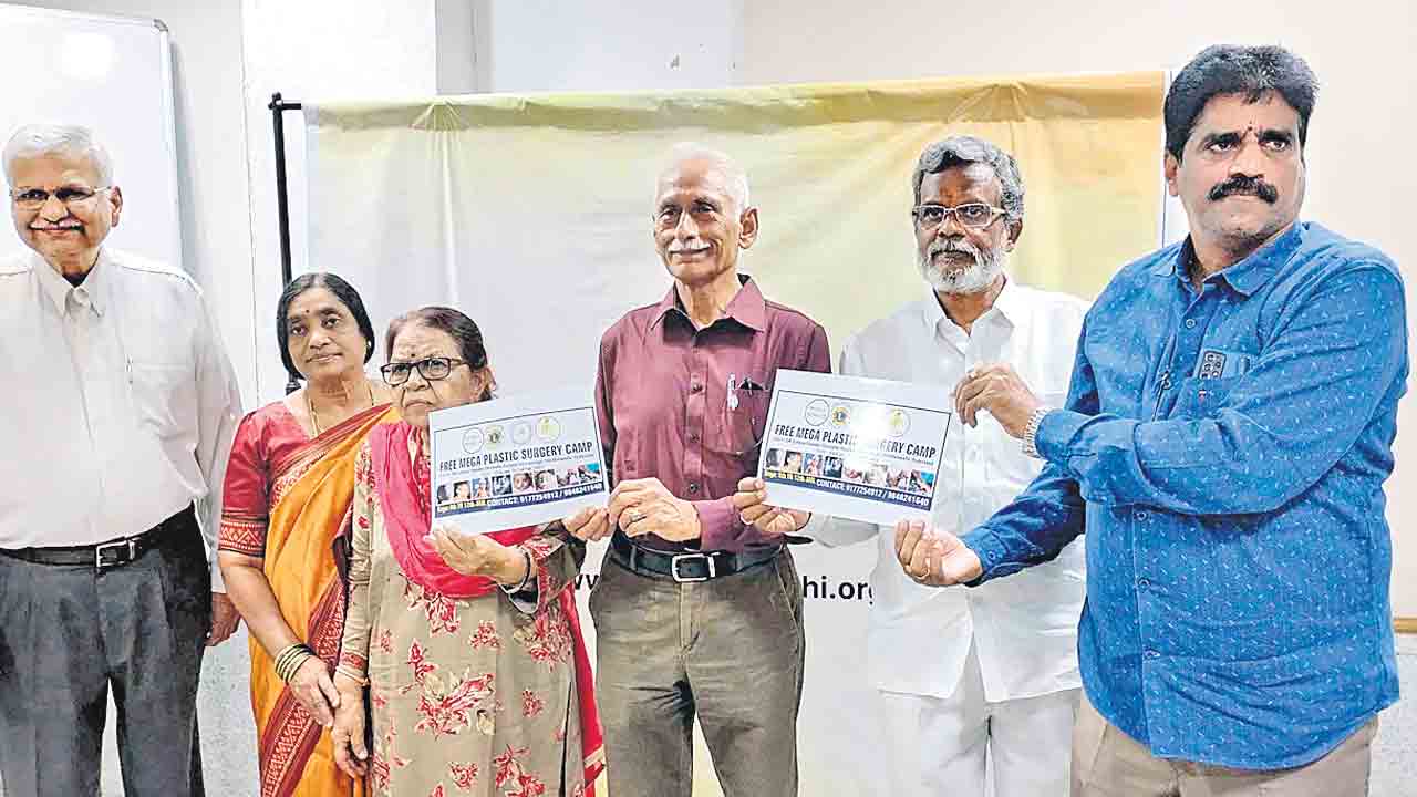 150 మంది నిరుపేదలకు ఉచిత మెగా ప్లాస్టిక్‌ సర్జరీ శిబిరం