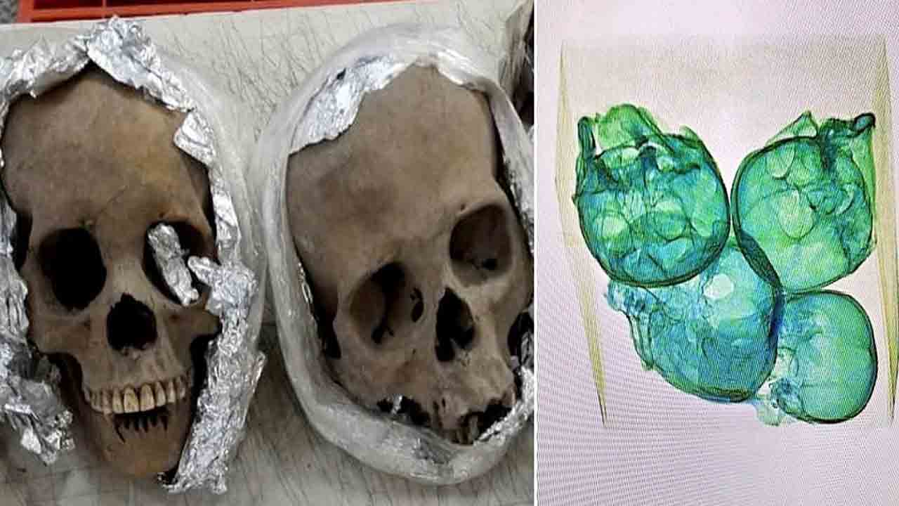 సూట్‌ కేసులో మనుషుల పుర్రెలు.. ఎయిర్‌పోర్ట్‌ కస్టమ్స్‌ అధికారులు షాక్..!