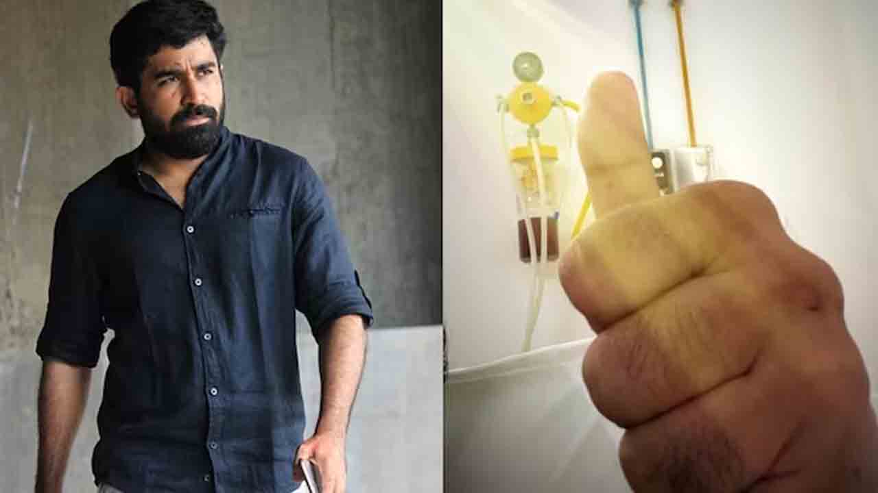 Vijay Antony | ప్రమాదం తర్వాత తొలిసారి స్పందించిన విజయ్ ఆంటోనీ.. మేజర్ సర్జరీ పూర్తైందంటూ పోస్ట్..!