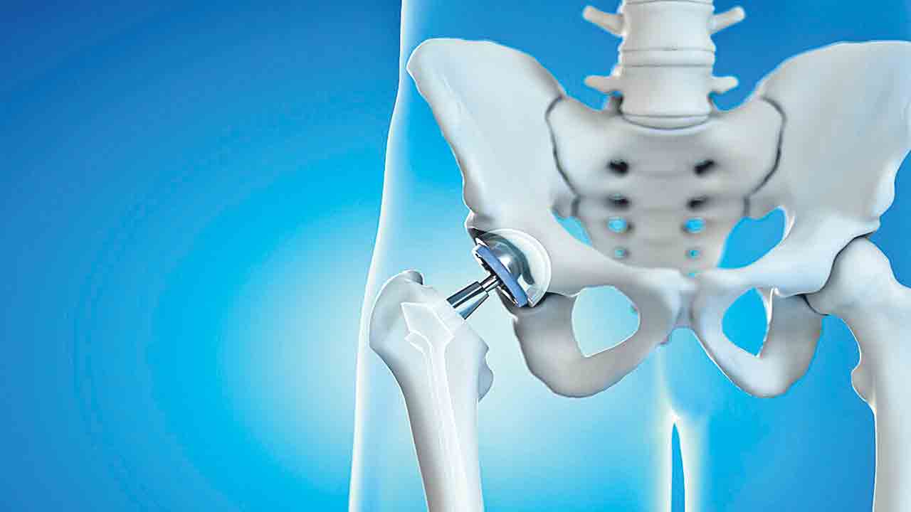 15 నిమిషాల్లోనే తుంటి మార్పిడి