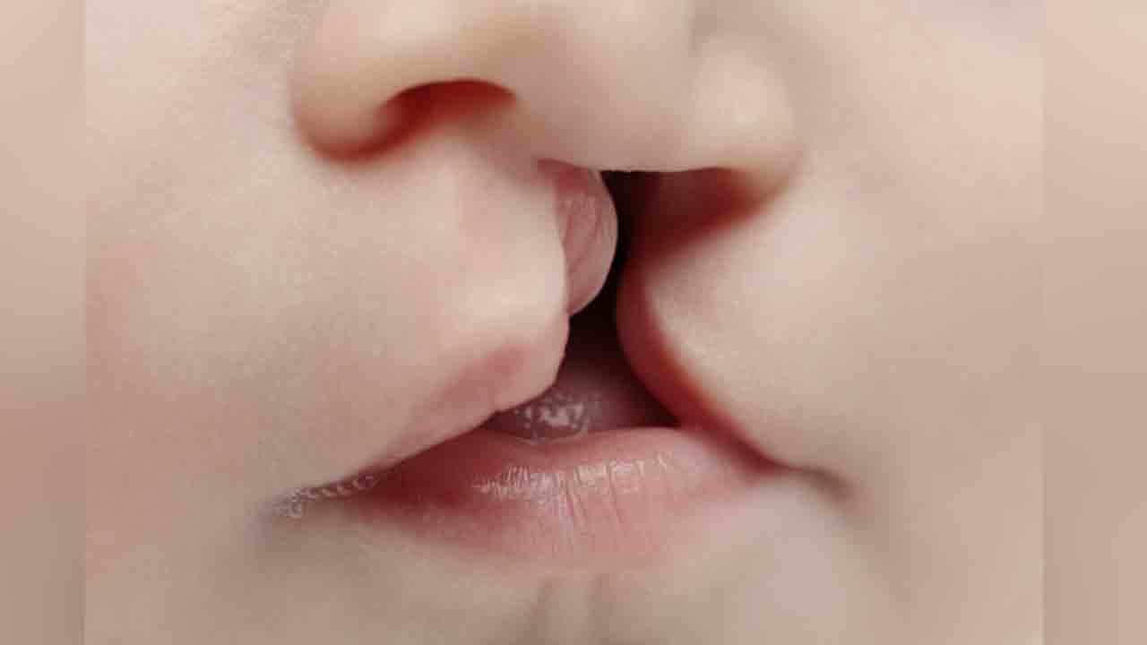 10 రోజులు.. ఉచిత ప్లాస్టిక్‌ సర్జరీ