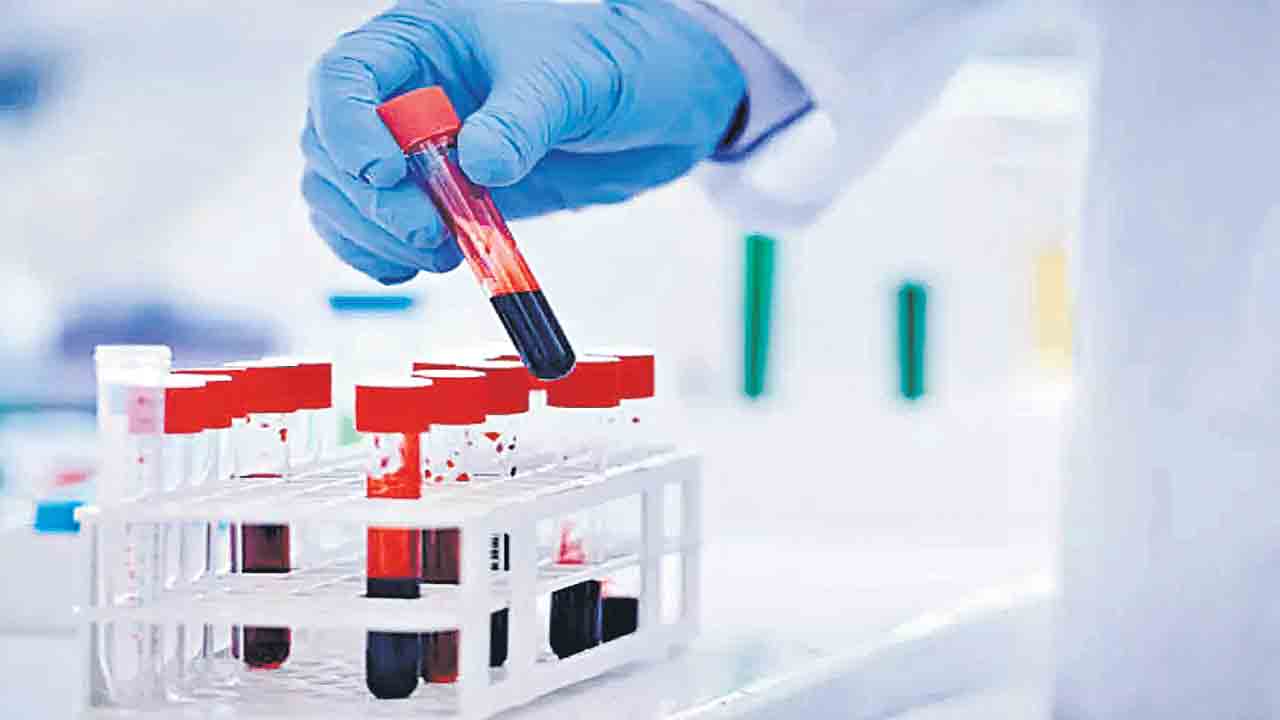 ముందుగానే అల్జీమర్స్ గుర్తించే రక్తపరీక్ష