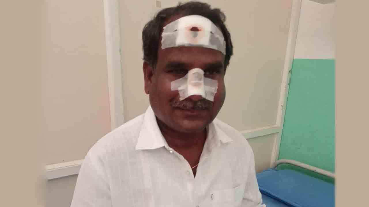 బీఆర్‌ఎస్‌ శ్రేణులపై ఎమ్మెల్యే అనుచరుల దాడి