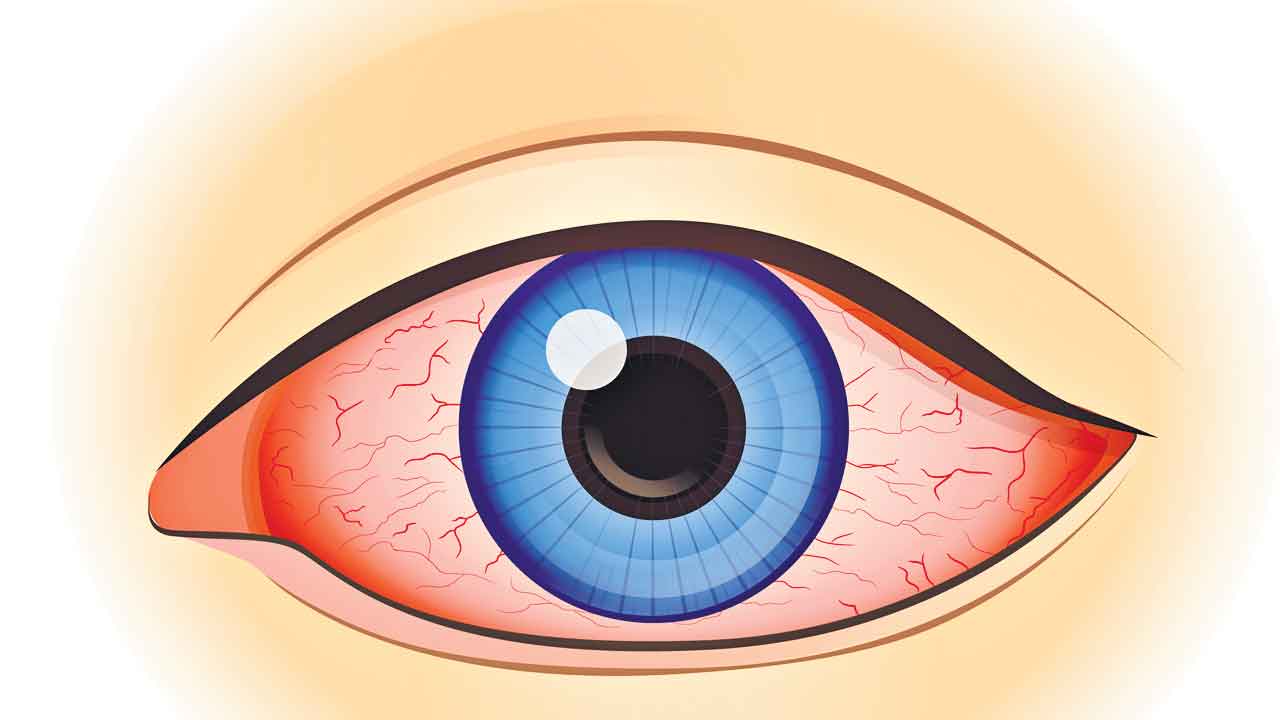 నయనం.. నవీనం