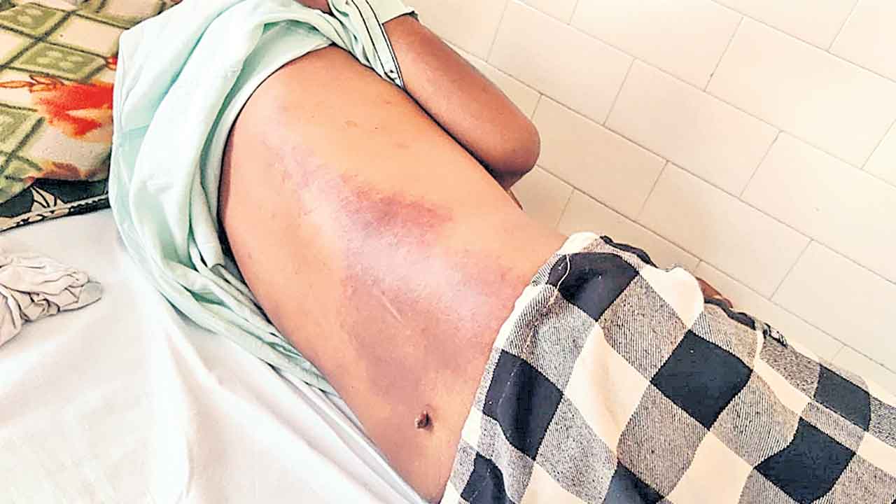 నిందితుడిపై పోలీసుల ప్రతాపం