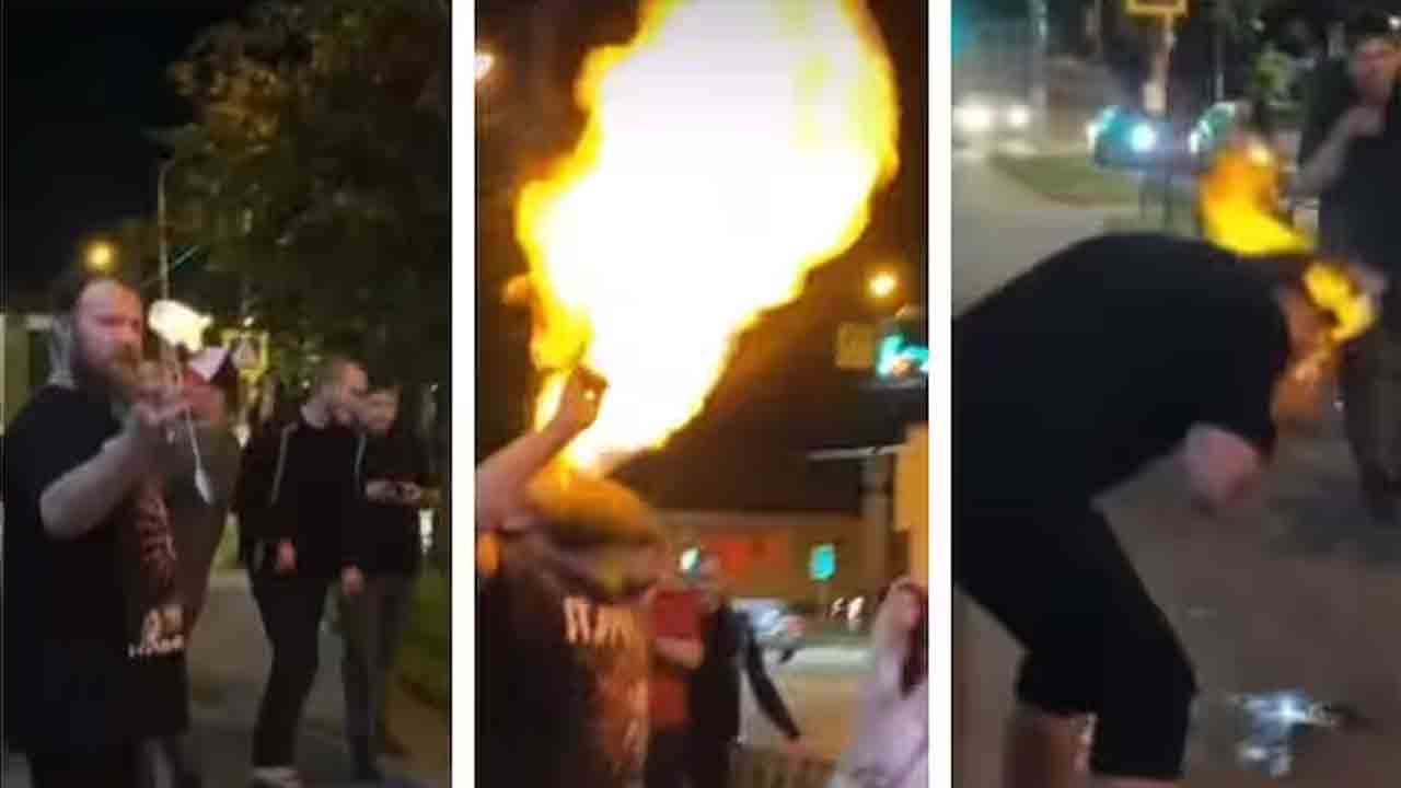 Horrific Video | ఫైర్‌ బ్రీతింగ్‌ చేయబోయి ముఖం కాల్చుకున్నాడు