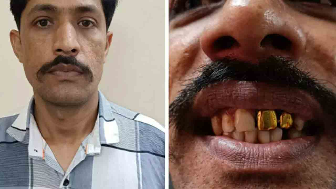 15 ఏళ్లుగా వ్యక్తి పరార్‌.. పోలీసులకు పట్టిచ్చిన బంగారం పళ్లు